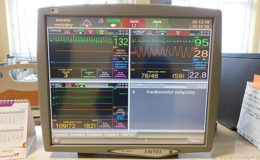 Nasz szpital kupił kardiomonitory i centralę monitorującą