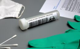 Koronawirus, sytuacja epidemiologiczna na dzień 24 sierpnia (poniedziałek)